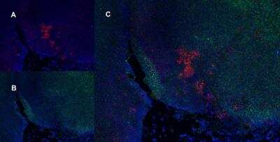 Immunocytochemistry/ Immunofluorescence: CD25/IL-2R alpha Antibody (OX-39) - BSA Free [NB100-64761]