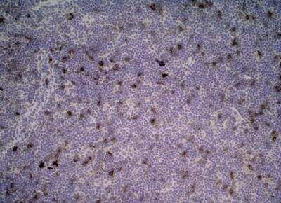 Immunohistochemistry-Paraffin: CD25/IL-2R alpha Antibody (OX-39) - BSA Free [NB100-64761]