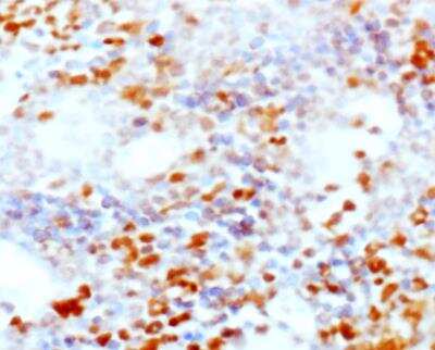 Immunohistochemistry-Paraffin: CD25/IL-2R alpha Antibody (PC61.5.3) - BSA Free [NB600-710]