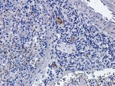 Immunohistochemistry: CD25/IL-2R alpha Antibody (Basiliximab) - Chimeric - Azide and BSA Free [NBP2-75902]