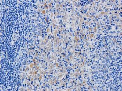 Immunohistochemistry: CD25/IL-2R alpha Antibody (Daclizumab) - Azide and BSA Free [NBP2-75901]