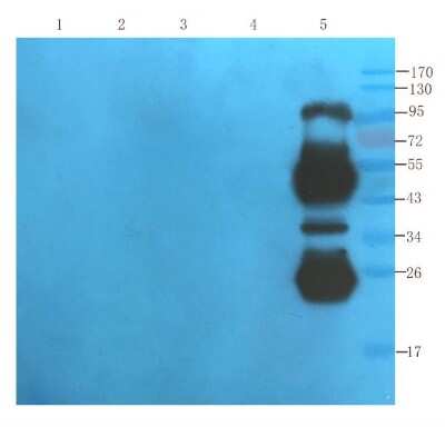 Western Blot: CD25/IL-2R alpha Antibody (Daclizumab)Azide and BSA Free [NBP2-75901]