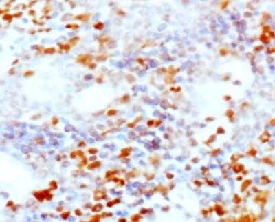 Immunohistochemistry: CD25/IL-2R alpha Antibody (PC61.5.3) - Azide and BSA Free [NBP2-80637]