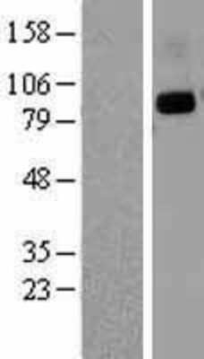 Western Blot: DPPIV/CD26 Overexpression Lysate [NBL1-09997]