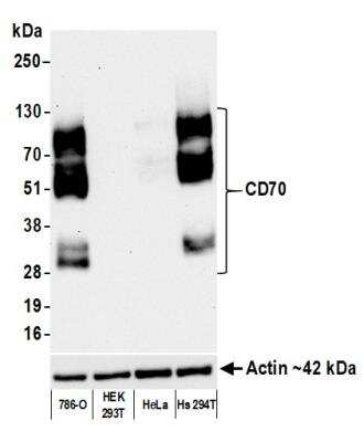 Western Blot: CD27 Ligand/TNFSF7/CD70 Antibody (BLR176J) [NBP3-14748]