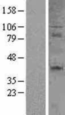 Western Blot: CD27/TNFRSF7 Overexpression Lysate [NBL1-08927]