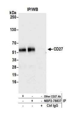 Immunoprecipitation: CD27/TNFRSF7 Antibody (BLR083G) [NBP2-78837]