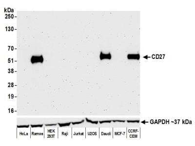 Western Blot: CD27/TNFRSF7 Antibody (BLR083G) [NBP2-78837]