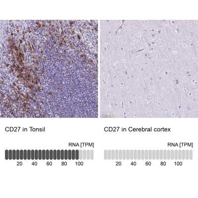 Immunohistochemistry-Paraffin: CD27/TNFRSF7 Antibody [NBP2-38434]