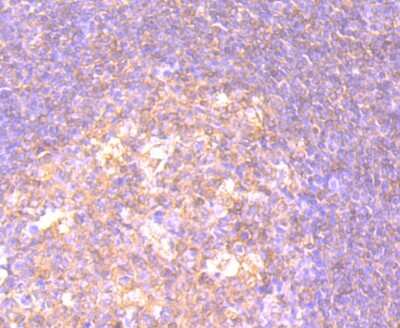Immunohistochemistry-Paraffin: CD27/TNFRSF7 Antibody (JB40-98) [NBP2-75434]