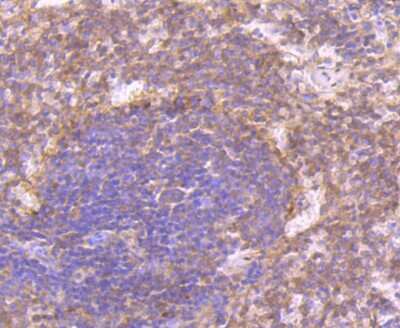 Immunohistochemistry-Paraffin: CD27/TNFRSF7 Antibody (JB40-98) [NBP2-75434]
