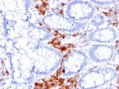 Immunohistochemistry-Paraffin: CD27/TNFRSF7 Antibody (LPFS2/1611) - Azide and BSA Free [NBP2-54582]
