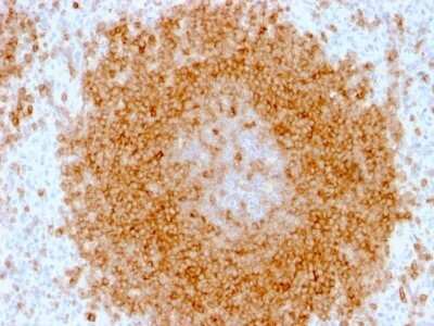 Immunohistochemistry-Paraffin: CD27/TNFRSF7 Antibody (LPFS2/1611) - Azide and BSA Free [NBP2-54582]