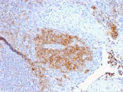 Immunohistochemistry-Paraffin: CD27/TNFRSF7 Antibody (LPFS2/1611) - Azide and BSA Free [NBP2-54582]