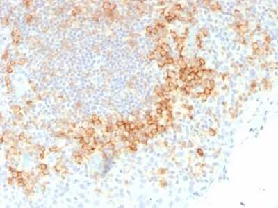 Immunohistochemistry-Paraffin: CD27/TNFRSF7 Antibody (LPFS2/1611) [NBP2-53196]