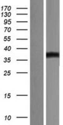 Western Blot: B7-H3/CD276 Overexpression Lysate [NBP2-06214]