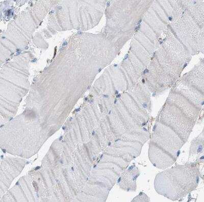 Immunohistochemistry-Paraffin: CD277/BTN3A1 Antibody [NBP1-90750]