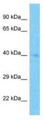 Western Blot: CD277/BTN3A1 Antibody [NBP3-10705]