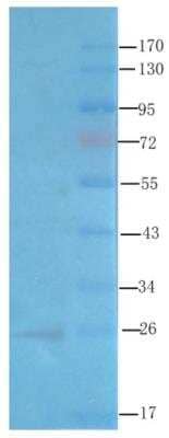 Western Blot: CD28 Antibody (D665)ChimericAzide and BSA Free [NBP2-81054]