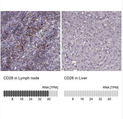 Immunohistochemistry-Paraffin: CD28 Antibody [NBP2-57015]