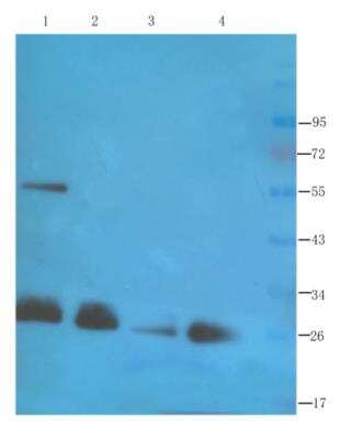 Western Blot: CD28 Antibody (JJ316)ChimericAzide and BSA Free [NBP2-81052]