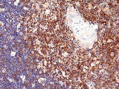 Immunohistochemistry-Paraffin: CD28 Antibody (RM404) [NBP2-89091]