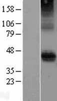 Western Blot: CD28 Overexpression Lysate [NBP2-04308]