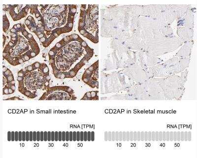 Immunohistochemistry-Paraffin: CD2AP Antibody [NBP1-90625]