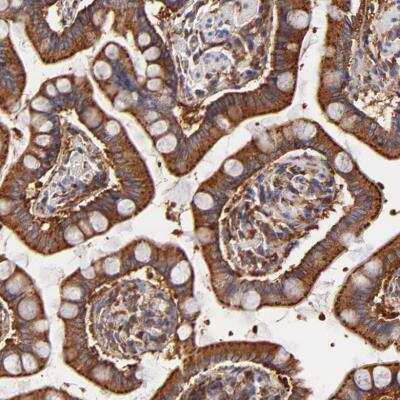 Immunohistochemistry-Paraffin: CD2AP Antibody [NBP1-90625]