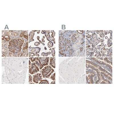 Immunohistochemistry-Paraffin: CD2AP Antibody [NBP1-90625]