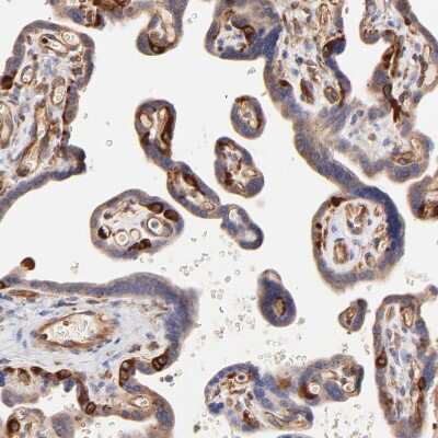 Immunohistochemistry-Paraffin: CD2AP Antibody [NBP1-90625]