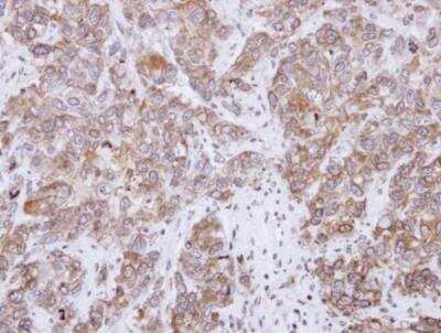 Immunohistochemistry-Paraffin: CD2AP Antibody [NBP2-53098]