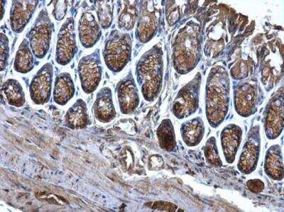 Immunohistochemistry-Paraffin: CD2AP Antibody [NBP2-53098]