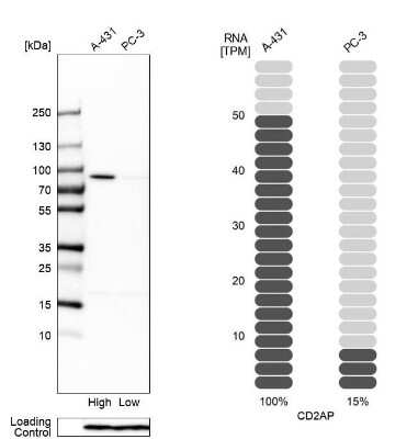 Western Blot: CD2AP Antibody [NBP1-90625]
