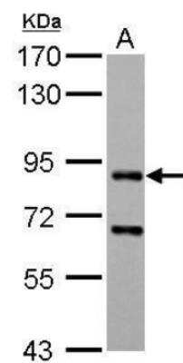 Western Blot: CD2AP Antibody [NBP2-53098]