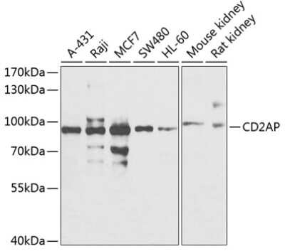 Western Blot: CD2AP AntibodyAzide and BSA Free [NBP2-92517]