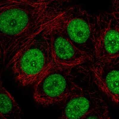 Immunocytochemistry/ Immunofluorescence: CD2BP2 Antibody [NBP2-49328]