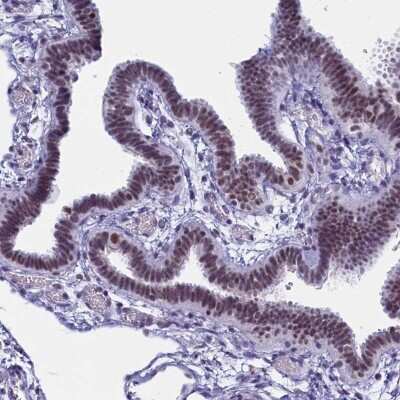 Immunohistochemistry-Paraffin: CD2BP2 Antibody [NBP2-47516]