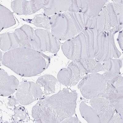 Immunohistochemistry-Paraffin: CD2BP2 Antibody [NBP2-47516]