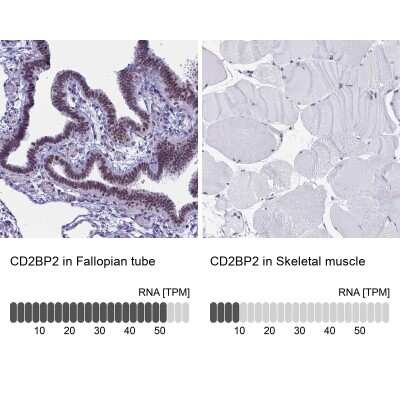 Immunohistochemistry-Paraffin: CD2BP2 Antibody [NBP2-47516]