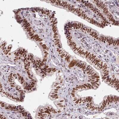 Immunohistochemistry-Paraffin: CD2BP2 Antibody [NBP2-49328]