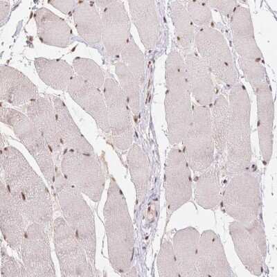 Immunohistochemistry-Paraffin: CD2BP2 Antibody [NBP2-49328]