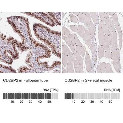 Immunohistochemistry-Paraffin: CD2BP2 Antibody [NBP2-49328]