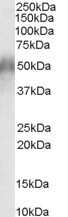 Western Blot: CD2BP2 Antibody [NB100-1526]