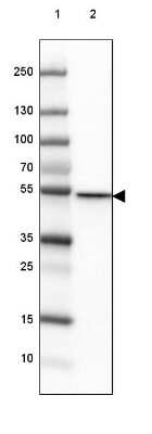 Western Blot: CD2BP2 Antibody [NBP2-47516]