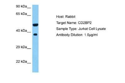 Western Blot: CD2BP2 Antibody [NBP2-87163]