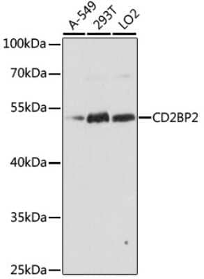 Western Blot: CD2BP2 AntibodyAzide and BSA Free [NBP2-92262]