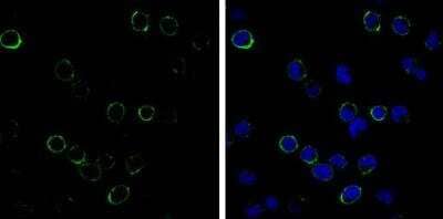 Immunocytochemistry/ Immunofluorescence: CD3 Antibody (13) [NBP2-43674]