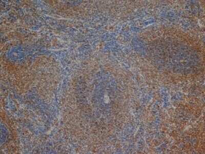 Immunohistochemistry-Paraffin: CD3 delta Antibody (1F4) [NB100-65230]