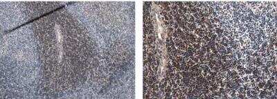 Immunohistochemistry-Paraffin: CD3 Antibody (RM0027-3B19) - Azide and BSA Free [NBP2-12159]